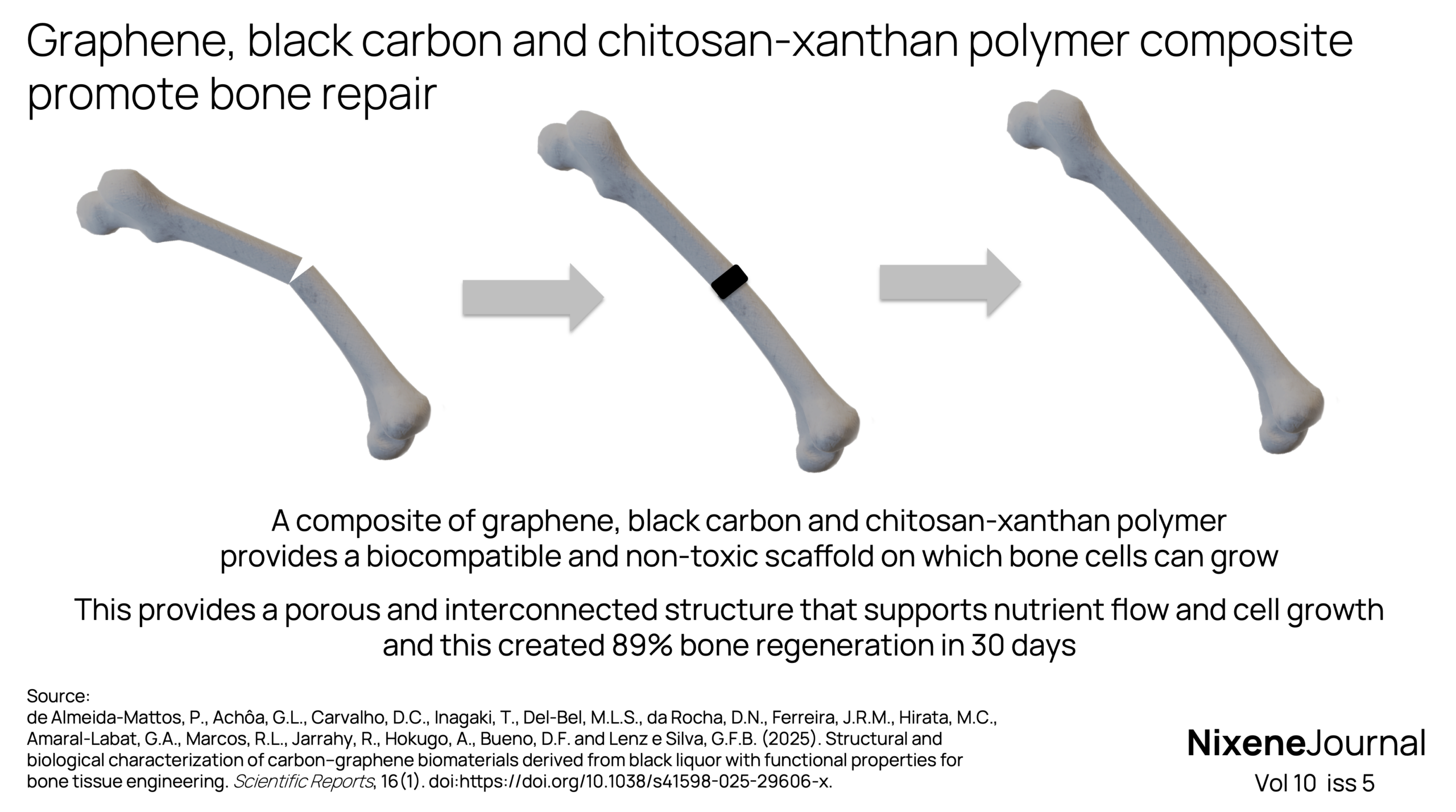 v10 i5 Graphene, black carbon and chitosan-xanthan polymer promote bone repair